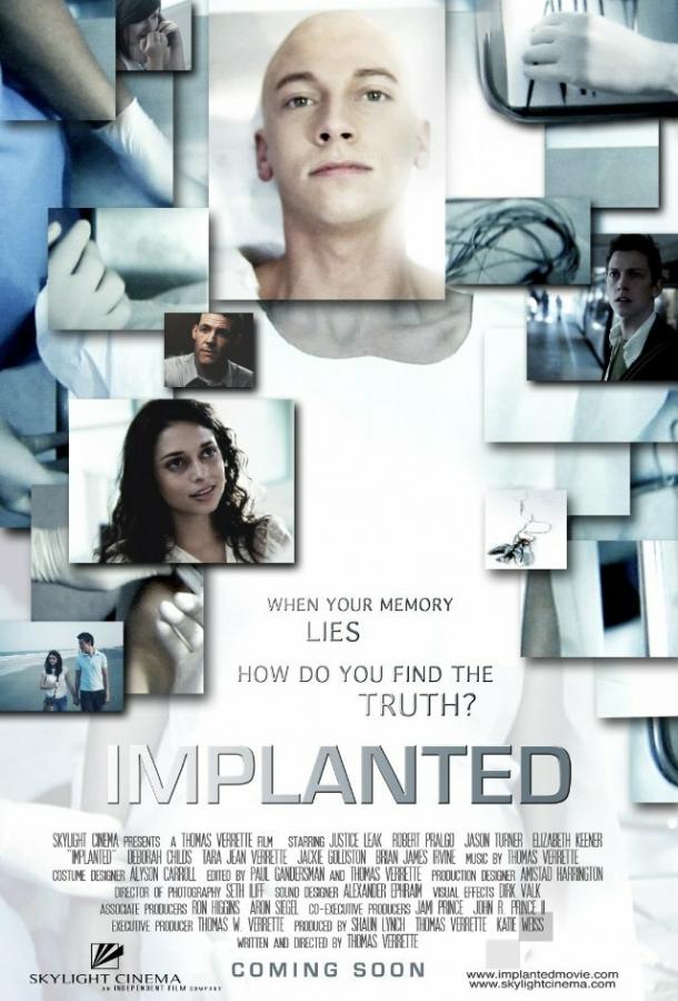 Имплант (2013) 
